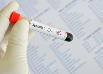Причины и лечение скрытого сифилиса Лечение позднего скрытого сифилиса